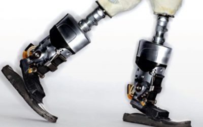 Βιονικά πόδια, i-Limb και άλλα «υπεράνθρωπα» προσθετικά μέλη που προκαλούν τη ζήλεια…