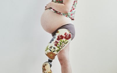 Christa Couture: φωτογραφίζοντας την εγκυμοσύνη με ένα προσθετικό πόδι