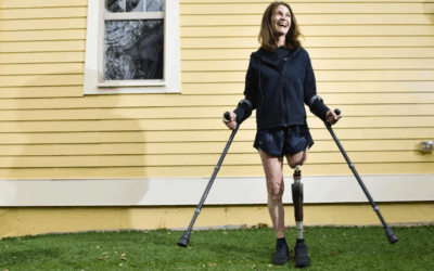 Πώς η οστεοενσωμάτωση χάρισε στην Τζάνετ ελευθερία ύστερα από 38 χρόνια